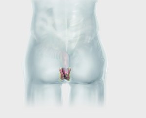 biolitec_KV_Proctology