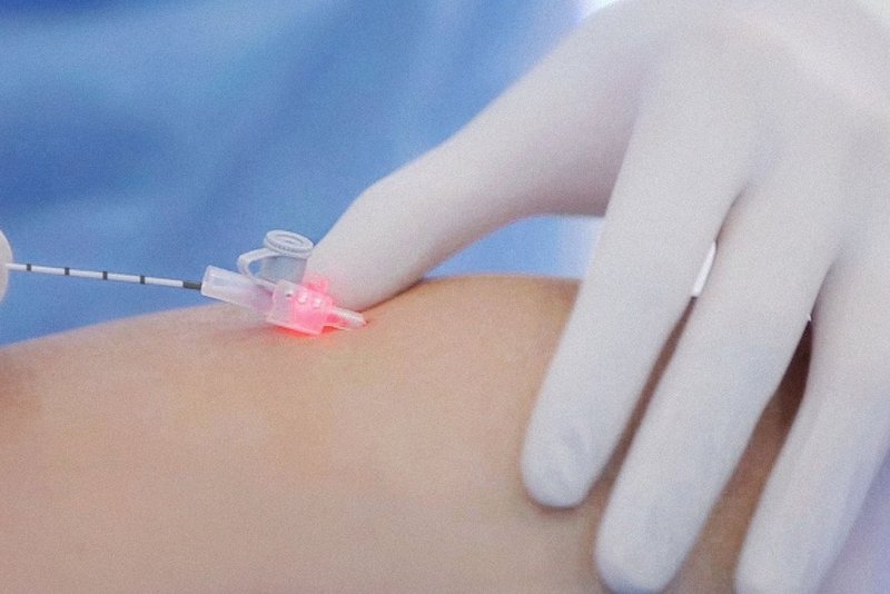 ELVeS_Radial_2ring-Faser_in_der_Kanüle_am_Bein_Zuschnitt