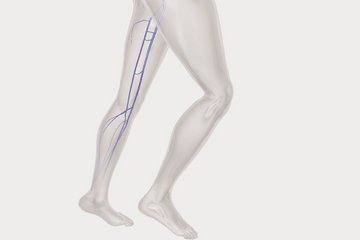 biolitec_KV_Phlebology_LQ