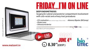 ePoster_Live_Laparoscopy_Prof_Malzoni_20210601